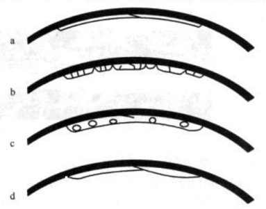 Figure 3-88 Abnormal coating after curing