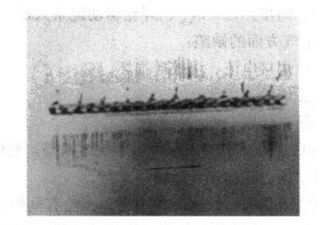The illustrated phenomenon (outer side) is very rare